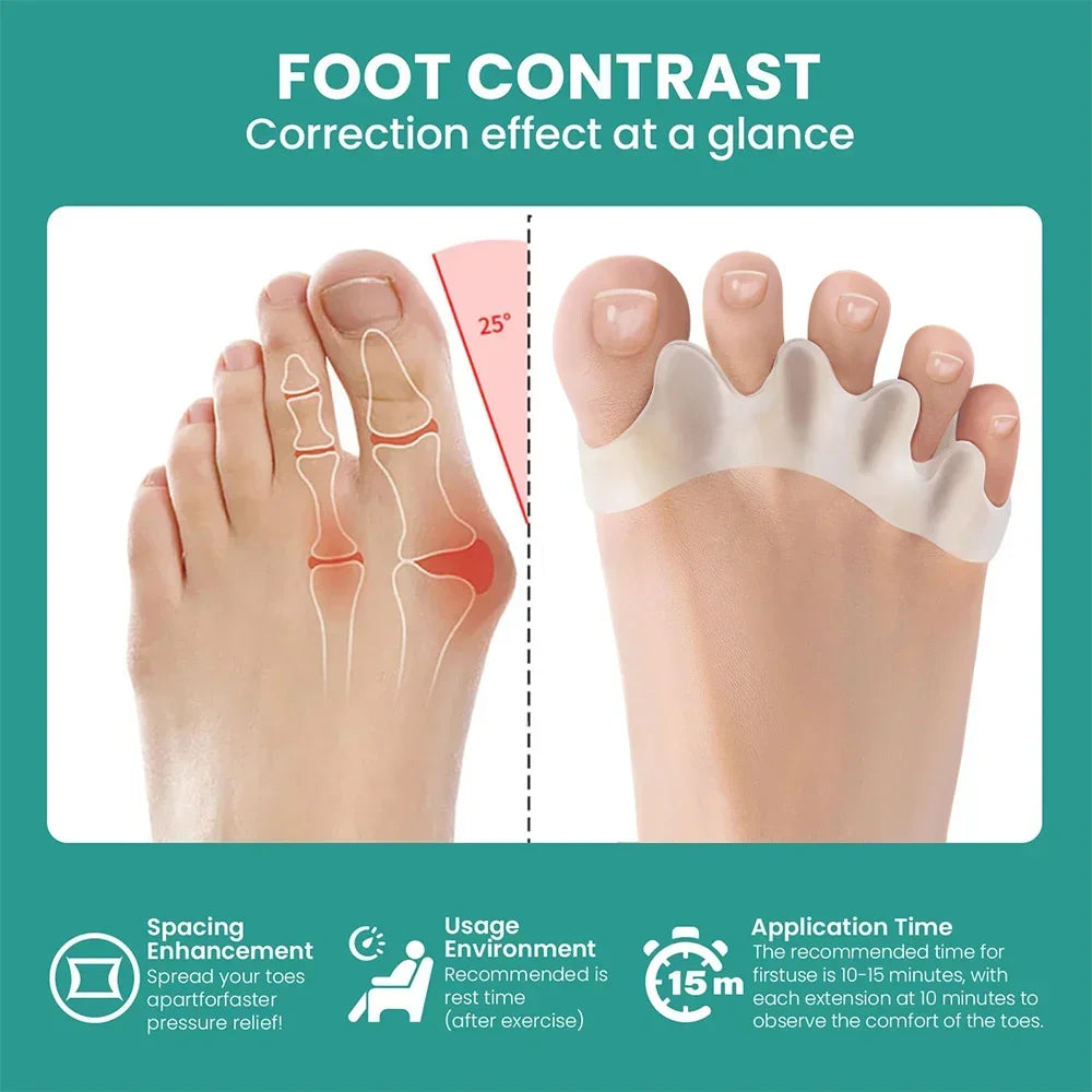 ToeAligner™ Spacer