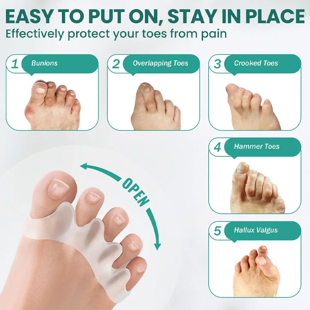 ToeAligner™ Spacer